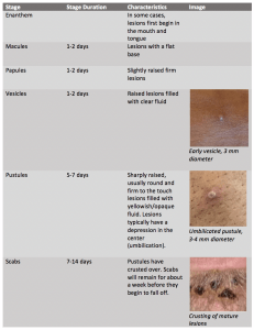 Symptoms of monkeypox differ from previous outbreaks