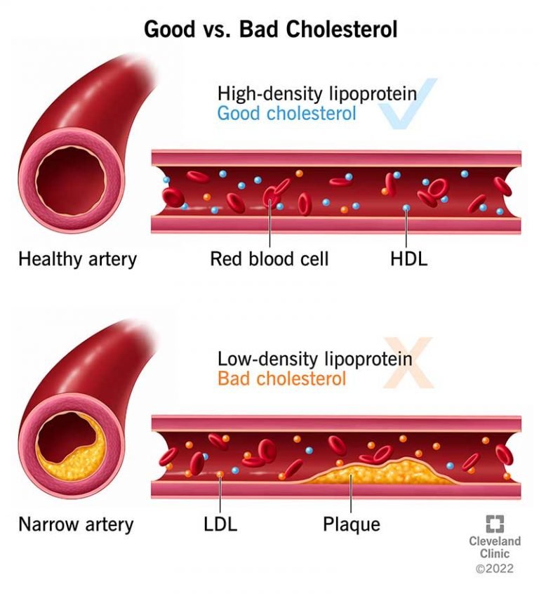 Methodologically flawed cholesterol study from 2016 used to support