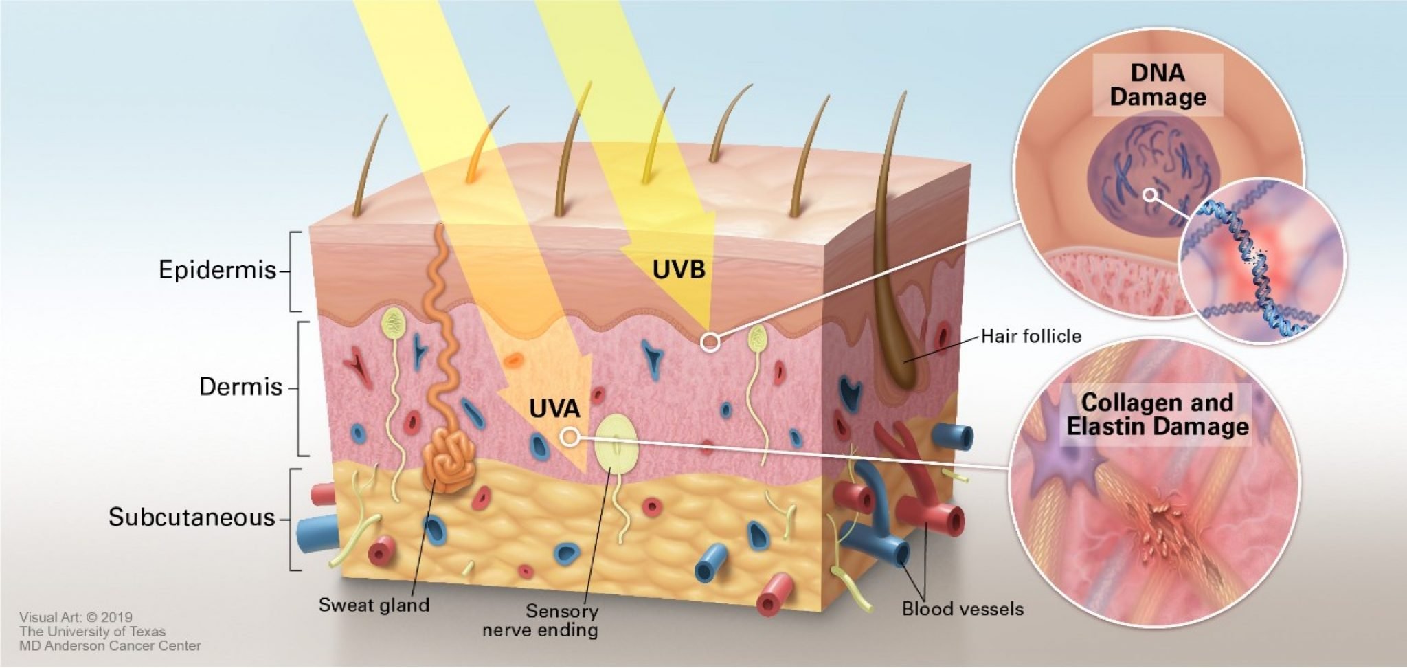 Unprotected sun overexposure, not sunscreen or sunglasses, causes ...